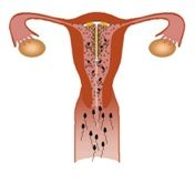 útero fisioterapia y osteopatia villena